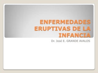 ENFERMEDADES
ERUPTIVAS DE LA
INFANCIA
Dr. José E. GRANDE AVALOS

 