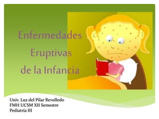Univ. Luz del Pilar Revolledo
FMH UCSM XII Semestre
Pediatría III
Enfermedades
Eruptivas
de la Infancia
 