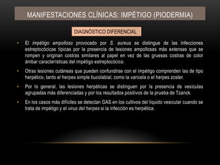 El impétigo ampolloso provocado por S. aureus se distingue de las infecciones estreptocócicas típicas por la presencia de lesiones ampollosas más extensas que se rompen y originan costras similares al papel en vez de las gruesas costras de color ámbar características del impétigo estreptocócico.Otras lesiones cutáneas que pueden confundirse con el impétigo comprenden las de tipo herpético, tanto el herpes simple bucolabial, como la varicela o el herpes zoster.Por lo general, las lesiones herpéticas se distinguen por la presencia de vesículas agrupadas más diferenciadas y por los resultados positivos de la prueba de Tzanck.En los casos más difíciles se detectan GAS en los cultivos del líquido vesicular cuando se trata de impétigo y el virus del herpes si la infección es herpética.Manifestaciones clínicas: IMPÉTIGO (PIODERMIA)DIAGNÓSTICO DIFERENCIAL