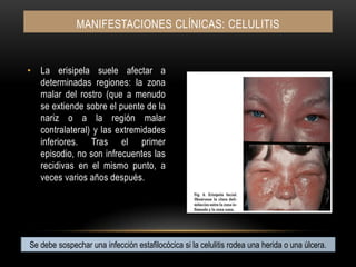 La erisipela suele afectar a determinadas regiones: la zona malar del rostro (que a menudo se extiende sobre el puente de la nariz o a la región malar contralateral) y las extremidades inferiores. Tras el primer episodio, no son infrecuentes las recidivas en el mismo punto, a veces varios años después.Manifestaciones clínicas: CELULITISSe debe sospechar una infección estafilocócica si la celulitis rodea una herida o una úlcera.