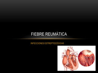 INFECCIONES ESTREPTOCÓCICASFIEBRE REUMÁTICA