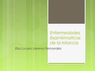 Enfermedades
Exantematicas
de la Infancia
Elsa Lucero Llerena Fernandez
 