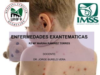 ENFERMEDADES EXANTEMATICAS
R2 MF MARINA RAMIREZ TORRES
DOCENTE:
DR. JORGE BURELO VERA
 