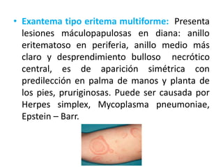 abordaje-del-ni-o-con-exantema-s-guias-pptx