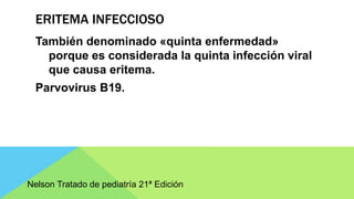 ERITEMA INFECCIOSO
También denominado «quinta enfermedad»
porque es considerada la quinta infección viral
que causa eritema.
Parvovirus B19.
Nelson Tratado de pediatría 21ª Edición
 