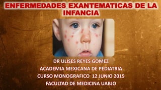 ENFERMEDADES EXANTEMATICAS DE LA
INFANCIA
DR ULISES REYES GOMEZ
ACADEMIA MEXICANA DE PEDIATRIA
CURSO MONOGRAFICO 12 JUNIO 2015
FACULTAD DE MEDICINA UABJO
 