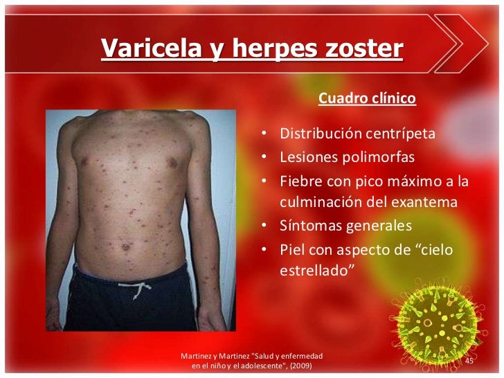 Enfermedades exantemáticas