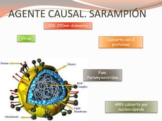 AGENTE CAUSAL. SARAMPIÓN
Virus Cubierta con 2
proteínas
ARN cubierto por
nucleocápside
100-250nm diámetro
Fam.
Paramyxoviridae
 