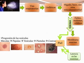 Vías
respiratorias Linfáticas
Hígado, bazo, sist
ema
reticuloendotelial
Fiebre,
malestar,
cefaleas
VIREMIA
Membrana
mucosaPiel
•Progresión de las vesículas
Máculas  Pápulas  Vesículas  Pústulas  Costras
Latencia
en las
neuronas
 