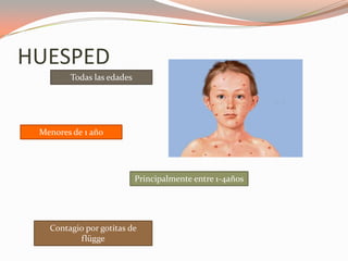 HUESPED
Todas las edades
Menores de 1 año
Principalmente entre 1-4años
Contagio por gotitas de
flügge
 