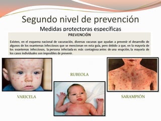 Segundo nivel de prevención
Medidas protectoras específicas
VARICELA
RUBEOLA
SARAMPIÓN
 
