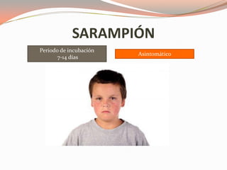 Periodo de incubación
7-14 días
Asintomático
SARAMPIÓN
 