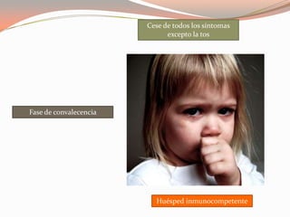Fase de convalecencia
Cese de todos los síntomas
excepto la tos
Huésped inmunocompetente
 