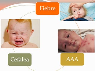 Fiebre
AAACefalea
 