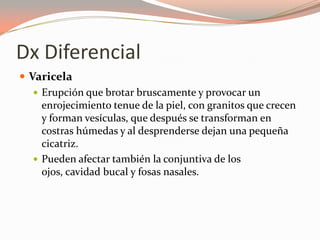 Dx Diferencial
 Varicela
 Erupción que brotar bruscamente y provocar un
enrojecimiento tenue de la piel, con granitos que crecen
y forman vesículas, que después se transforman en
costras húmedas y al desprenderse dejan una pequeña
cicatriz.
 Pueden afectar también la conjuntiva de los
ojos, cavidad bucal y fosas nasales.
 