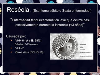Roséola. (Exantema súbito o Sexta enfermedad.)
“Enfermedad febril exantemática leve que ocurre casi
exclusivamente durante la lactancia (<3 años)”
Causada por:
 VHH-6 ( A y B: 99%)
Edades: 6-15 meses
 VHH-7
 Otros virus (ECHO 16)
 