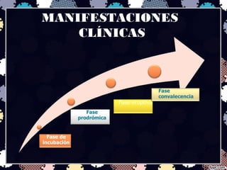 MANIFESTACIONES
CLÍNICAS
 