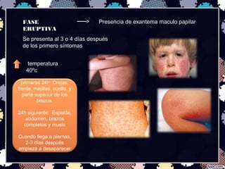 FASE
ERUPTIVA
Presencia de exantema maculo papilar
Se presenta al 3 o 4 días después
de los primero síntomas
temperatura
40ºc
primeras 24h: Orejas,
frente, mejillas, cuello, y
parte superior de los
brazos.
24h siguiente: Espalda,
abdomen, brazos
completos y muslo
Cuando llega a piernas,
2-3 días después
empieza a desaparecer
 