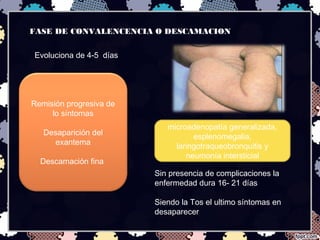 FASE DE CONVALENCENCIA O DESCAMACION
Evoluciona de 4-5 días
Remisión progresiva de
lo síntomas
Desaparición del
exantema
Descamación fina
Sin presencia de complicaciones la
enfermedad dura 16- 21 días
Siendo la Tos el ultimo síntomas en
desaparecer
microadenopatía generalizada,
esplenomegalia,
laringotraqueobronquitis y
neumonía intersticial
 