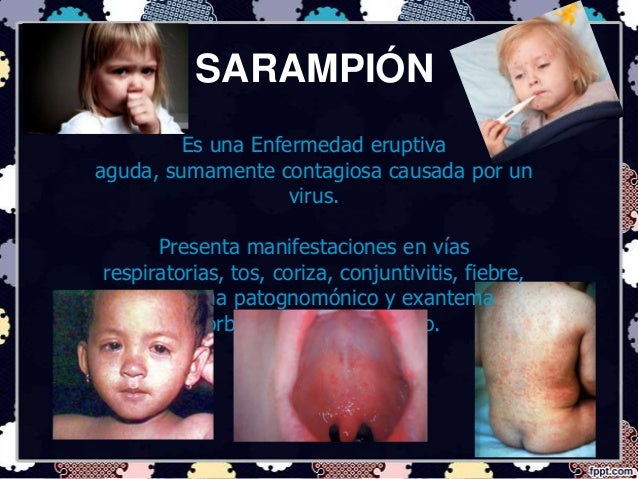 Enfermedades exantemáticas sarampion, rubeola,varicela y escarlatina