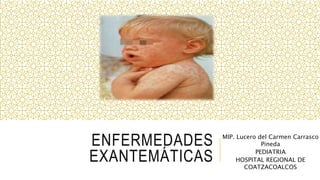 ENFERMEDADES
EXANTEMÁTICAS
MIP. Lucero del Carmen Carrasco
Pineda
PEDIATRIA
HOSPITAL REGIONAL DE
COATZACOALCOS
 