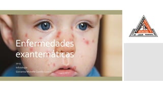 Enfermedades
exantemáticas
10-9
Infctología
Giovanna Michelle Castillo Galavíz
 