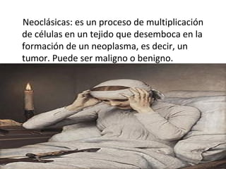 Neoclásicas: es un proceso de multiplicación
de células en un tejido que desemboca en la
formación de un neoplasma, es decir, un
tumor. Puede ser maligno o benigno.
 