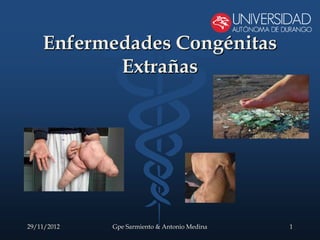 Enfermedades Congénitas
           Extrañas




29/11/2012   Gpe Sarmiento & Antonio Medina   1
 