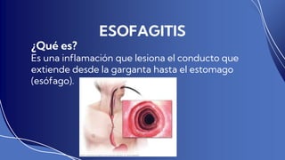 enfermedades gastrointestinales.pptx
