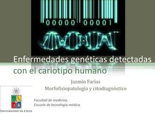 Enfermedades genéticas detectadas
con el cariotipo humano
Jazmín Farías
Morfofisiopatología y citodiagnóstico
Facultad de medicina.
Escuela de tecnología médica

 