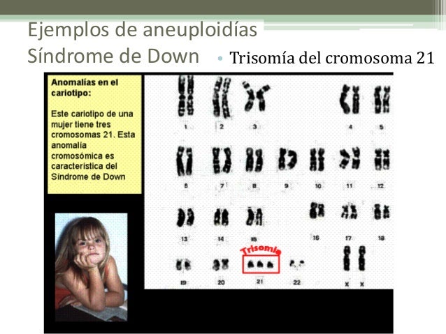 El Sindrome De Down Es Una Monosomia Y