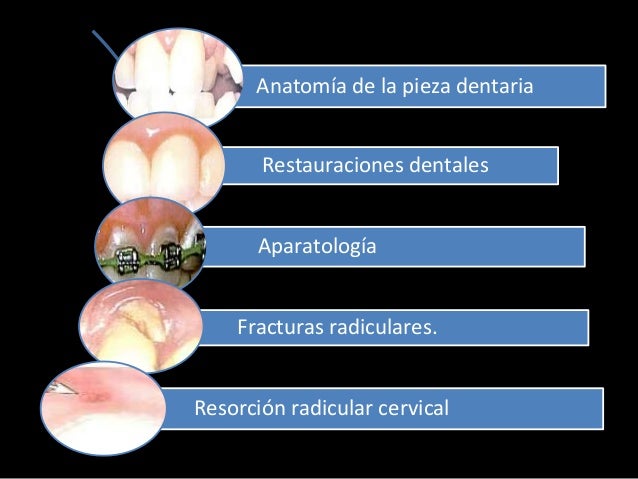 Enfermedades gingivales inducidas por la placa bacteriana
