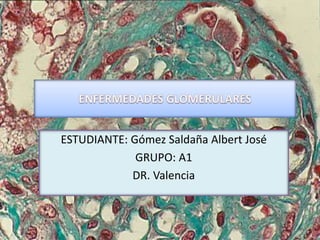 ESTUDIANTE: Gómez Saldaña Albert José
GRUPO: A1
DR. Valencia
 