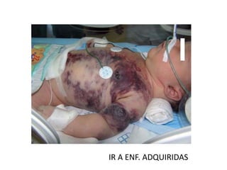 IR A ENF. ADQUIRIDAS
 