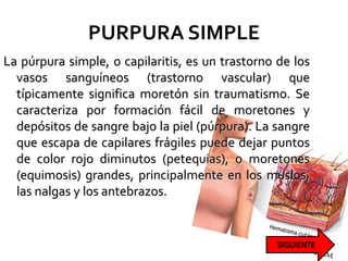 PURPURA SIMPLE
La púrpura simple, o capilaritis, es un trastorno de los
vasos sanguíneos (trastorno vascular) que
típicamente significa moretón sin traumatismo. Se
caracteriza por formación fácil de moretones y
depósitos de sangre bajo la piel (púrpura). La sangre
que escapa de capilares frágiles puede dejar puntos
de color rojo diminutos (petequias), o moretones
(equimosis) grandes, principalmente en los muslos,
las nalgas y los antebrazos.
 