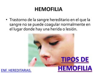 HEMOFILIA
• Trastorno de la sangre hereditario en el que la
sangre no se puede coagular normalmente en
el lugar donde hay una herida o lesión.
ENF. HEREDITARIAS.
 