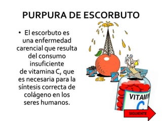 PURPURA DE ESCORBUTO
• El escorbuto es
una enfermedad
carencial que resulta
del consumo
insuficiente
de vitaminaC, que
es necesaria para la
síntesis correcta de
colágeno en los
seres humanos.
 