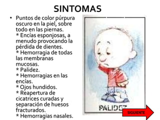 SINTOMAS
• Puntos de color púrpura
oscuro en la piel, sobre
todo en las piernas.
* Encías esponjosas, a
menudo provocando la
pérdida de dientes.
* Hemorragia de todas
las membranas
mucosas.
* Palidez.
* Hemorragias en las
encías.
* Ojos hundidos.
* Reapertura de
cicatrices curadas y
separación de huesos
fracturados.
* Hemorragias nasales.
 