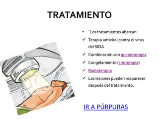 TRATAMIENTO
• ´Los tratamientos abarcan:
 Terapia antiviral contra el virus
del SIDA
 Combinación con quimioterapia
 Congelamiento (crioterapia)
 Radioterapia
 Las lesiones pueden reaparecer
después del tratamiento.
IR A PÚRPURAS
 