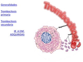 Generalidades
Trombocitosis
primaria
Trombocitosis
secundaria
IR A ENF.
ADQUIRIDAS
 