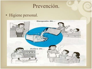 Prevención. 
• Higiene personal. 
 