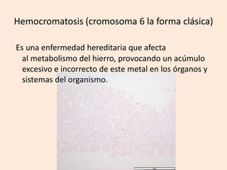 Hemocromatosis (cromosoma 6 la forma clásica)Es una enfermedad hereditaria que afecta al metabolismo del hierro, provocando un acúmulo excesivo e incorrecto de este metal en los órganos y sistemas del organismo.