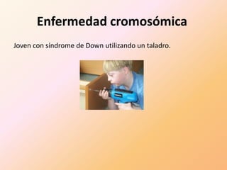 Enfermedad cromosómica Joven con síndrome de Down utilizando un taladro.