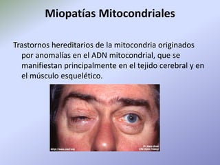 Miopatías MitocondrialesTrastornos hereditarios de la mitocondria originados por anomalías en el ADN mitocondrial, que se manifiestan principalmente en el tejido cerebral y en el músculo esquelético. 