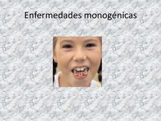 Enfermedades monogénicas