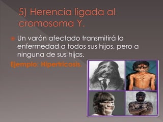  Un varón afectado transmitirá la
enfermedad a todos sus hijos, pero a
ninguna de sus hijas.
Ejemplo: Hipertricosis.
 