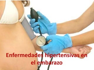 Enfermedades hipertensivas en 
el embarazo 
 
