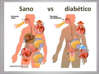 Enfermedades hormonales