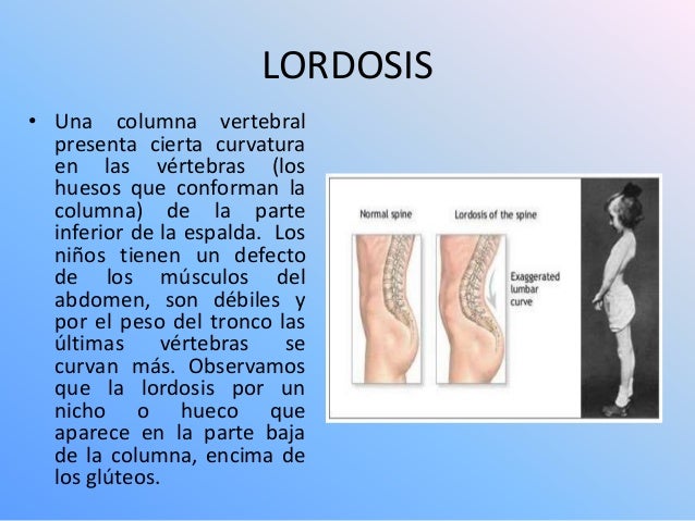 El aparato láser para el tratamiento de la columna vertebral