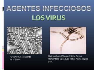 POLIOVIRUS ,causante
de la polio.
El virus ébola (filovirus) tiene forma
filamentosa y produce fiebre hemorrágica
viral.
 
